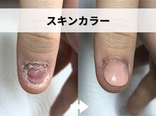 ブルームーンネイルズ(BLOOMOON.nails)/スキンカラー