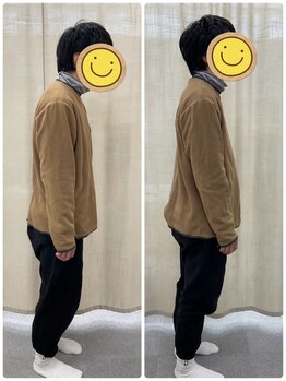 姿勢矯正院/猫背は改善する!