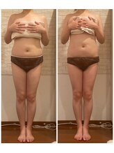 うつくし痩身 美サロン ゼットワン(Z-ONE)/メディセル＋ハンドマッサージ