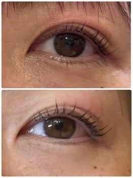 イスム(isum)/コスメリフト美容液コース