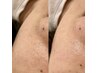 口周りor鼻or鼻毛orでこ　パーツごとの部分wax