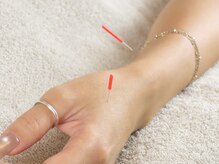 ビーネ 札幌琴似/ハリスリム 札幌琴似(Beene/Hari-Slim)/痩身鍼灸施術