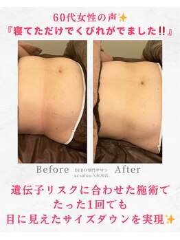 エーシーサロン 六本木店(acsalon)/ウエスト出しはお任せください♪
