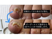 巻き爪じゅん 津田沼駅前店の雰囲気（当院の凄腕スタッフにお任せ！他店様で改善しなくても諦めないで）