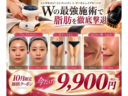 フェムプリュ(femplus)の写真