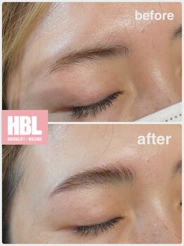 リコ(Lico)/美眉ハリウッドブロウリフト