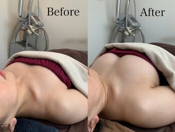 ジェイオー(J.O)/バストアップコルギ/小顔コルギ