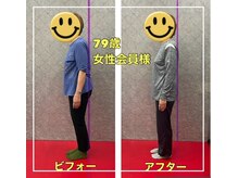 BDS/79歳女性会員様のビフォアフター