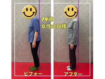 BDS/79歳女性会員様のビフォアフター