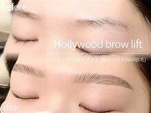 アルターアイズ(ALTER EYES)/ハリウッドブロウリフト(ＨＢＬ)