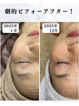 シーフェイス 横浜店(SEE FACE)/8か月間の劇的ビフォーアフター