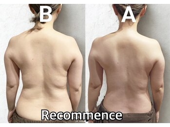 リコメンス(Recommence)/産後太りを４回で解消