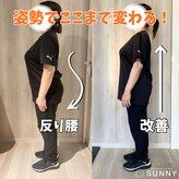 サニー(SUNNY)