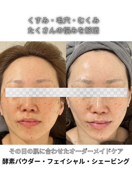 LUAの写真/シェービングはもちろん、自分に合った肌ケアでくすみのない透明感のある素肌に◎