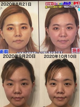 小顔堂 大阪心斎橋店/本場韓国小顔コルギ