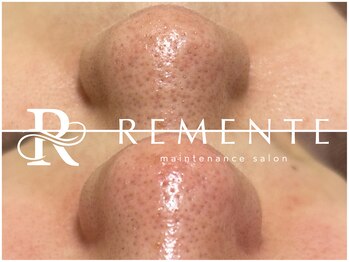 モテ 新宿店(Mote)/ハイドラ毛穴洗浄＋艶肌Wax 新宿