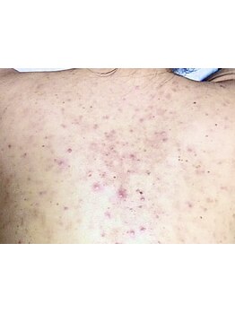 ブライダルメニューがあるサロン