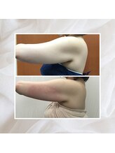 プリマプリート 名駅店/脂肪冷却