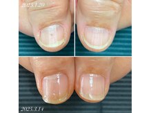 ダイヤモンドボディの雰囲気（【育爪ケア】爪のピンクの部分を縦長に育ててみませんか？）