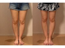 姿勢矯正院 千曲店/美容カイロで美脚！