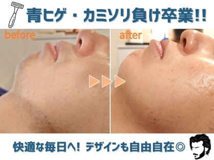 メンズ脱毛 マックス 蒲田店(MAX)の写真