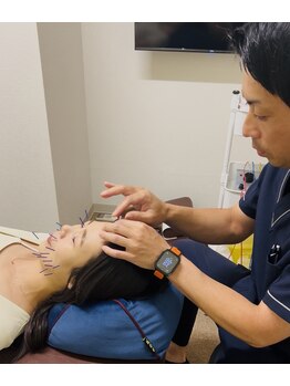 久留米まつもと整骨院 津福院/美容鍼