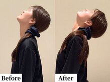 ソレア(Solea)/首こり改善1回目