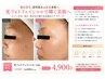 【シミ・くすみ・毛穴】光フェイシャルで透明感のある肌へ 6,600円→