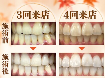 LBSホワイトニング 梅田店の写真