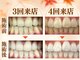 LBSホワイトニング 梅田店の写真