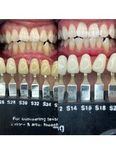 トウキョウスワーズ 池袋店(TOKYO SWRS)/#ホワイトニング #池袋 #渋谷