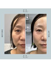 ラプティット(La petite)/40代女性/2回の変化