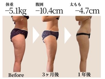 アナパ・オラの写真/頑固な凸凹セル脂肪/むくみは引締め効果抜群マグニート★蓄積脂肪を徹底分解&燃焼！最速で美脚に導く！