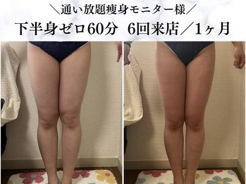 シーフェイス 横浜店(SEE FACE)/下半身ゼロダイエットモニター様