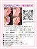 【大人気！】耳つぼジュエリー対面作成