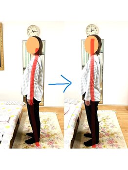 エスコート芦屋サロン/お腹を突き出してたつ　腰痛