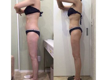 ルシアル 新宿代々木店(LUCIAL)/痩身オーダーメイド