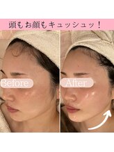 ココロ(COCORO)/フェイスライン、首元のたるみも