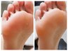 【FOOT】足爪ケア&角質除去 ￥8250