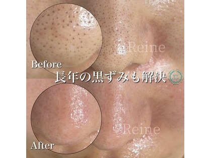 レーヌ(Reine)の写真