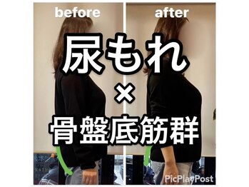 カワル整体 上通り院/尿もれは骨盤底筋の弱さから？