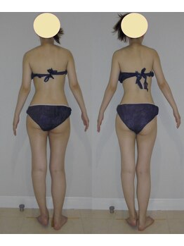 アルマ 芦屋(ALMA)/体幹バランスまで整うリジュ☆