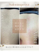 サロン インプルーヴ 久留米店(Salon improve)/背中光脱毛【before/after】