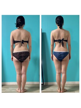 ネイト ワックス(Neit Wax)/痩身/ダイエット/マッサージ