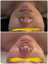 メディカルエステ ユウ(Yuu)/