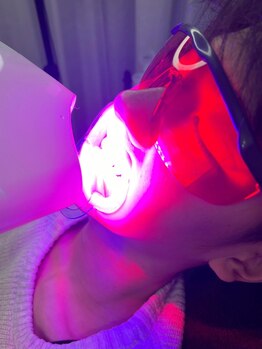 ソラナ(solana)の写真/≪LED出力最大！見違える白い歯を手に入れる！≫最強セルフホワイトニング20分×2回連続照射初回¥3980★