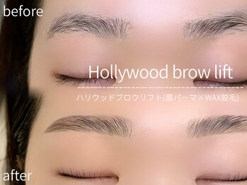 アルターアイズ(ALTER EYES)/ハリウッドブロウリフト(ＨＢＬ)