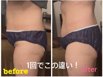 レア ルアン 西口店/インナーマッスルを鍛えて美姿勢