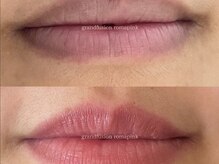 ジェニック(_genic)/ローマピンク