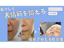 ミライ(Mirai)/たるみケア